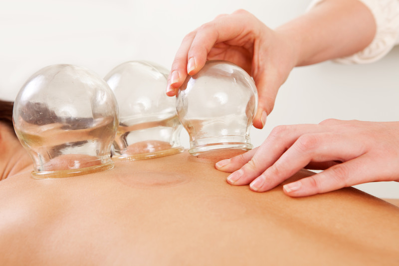 Cupping chronic pain