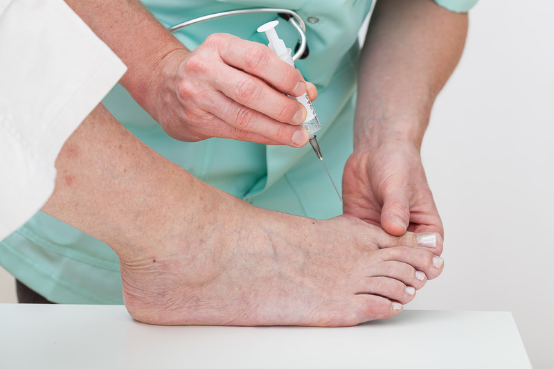 Injection Chronic Foot Pain