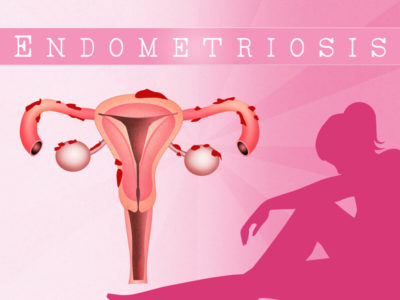 dietary changes help endometriosis pain